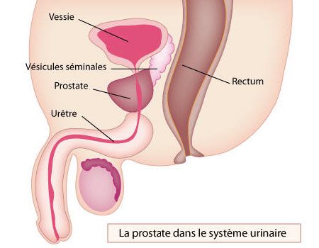 problème de prostate à 20 ans)