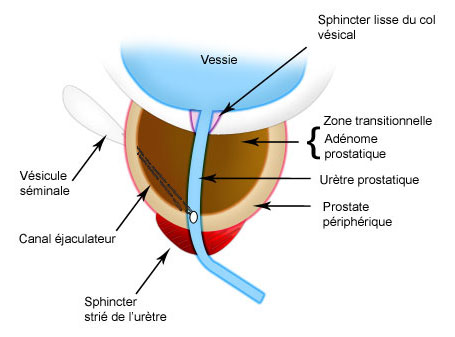 prostate_img2