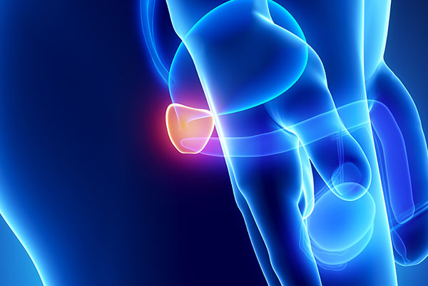 cancer_prostate